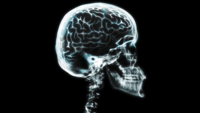 The Danish Brain Collection