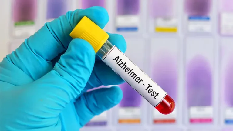 Swedish Researchers Diagnose Alzheimer’s at an Early Stage